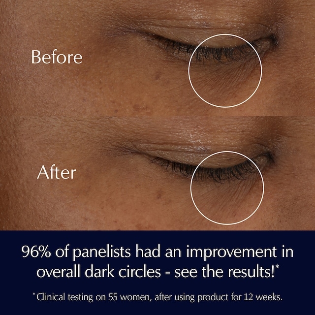Advanced Night Repair Eye Supercharged Gel-Creme 
