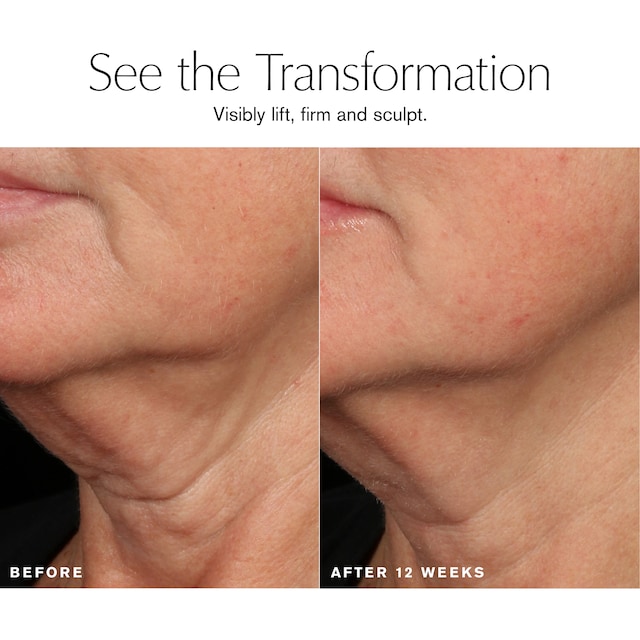 Revitalizing Supreme+